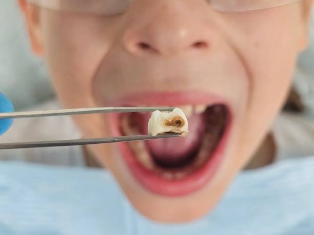 Best Dentist for Dental Trauma  in Exeter, PA
